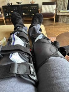 Two legs in black braces with ice packs, resting on a couch in a living room. The person is wearing gray pants and black slippers.